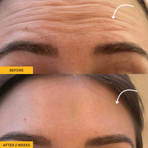 Lymphatic Contour Brush for Snatched Face