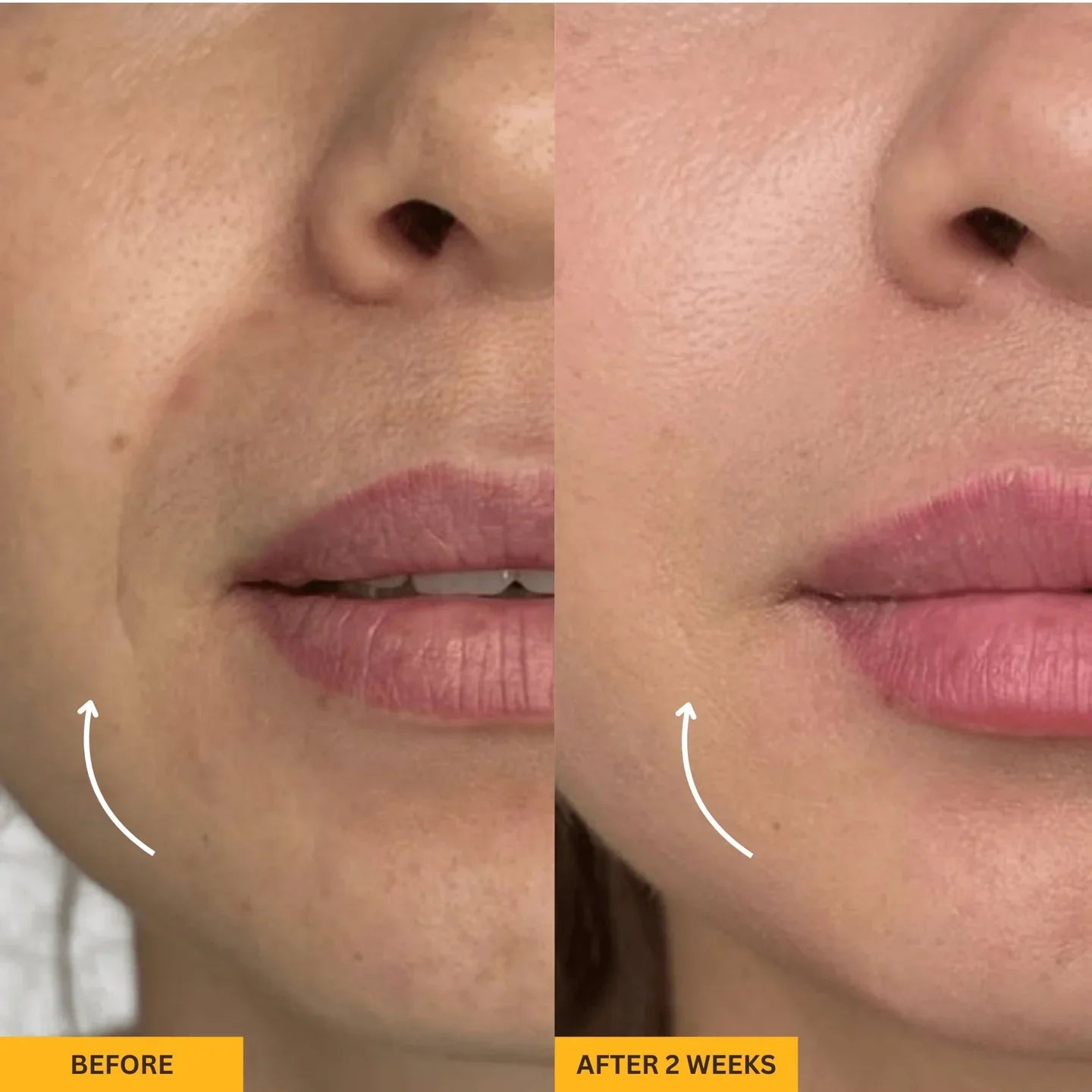 Lymphatic Contour Brush for Snatched Face