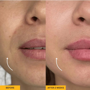 Lymphatic Contour Brush for Snatched Face