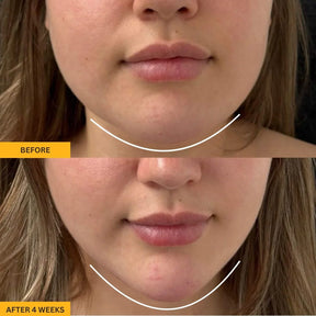 Lymphatic Contour Brush for Snatched Face